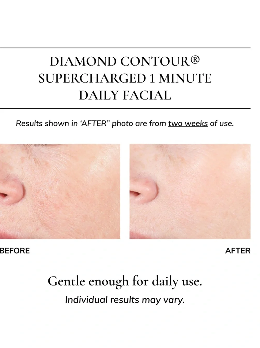 Kaplan MD Diamond Contour 1 Minute Daily Rejuvenating Facial Elixir 1.35/40ml